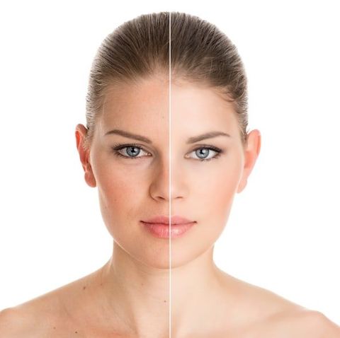 Skin Rejuvenation: Treatments, Benefits, Methods & Selection